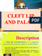 Cleft Lip and Palate