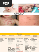 Varicela Herpes