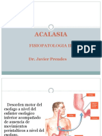 Acalasia