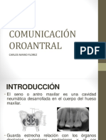 Comunicacion Oroantral