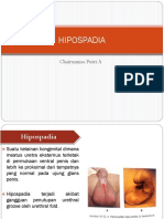 7798 Hipospadia