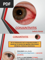 Conjuntivitis Charla ORIGNAL