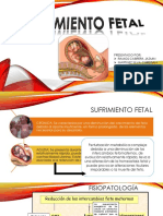 Sufrimiento Fetal