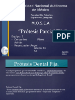 Prótesis Parcial Fija