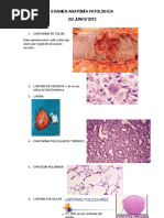 Examen Anatomía Patologica Junio 2012 Grado