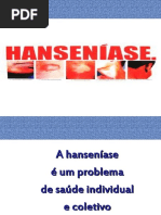 Hanseníase