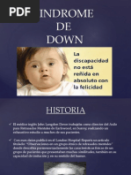 Sindrome de Down