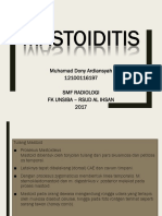 CSS Mastoiditis