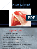 Stenoza Aortică