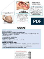 Cesarea Normativas