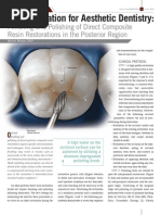 Finishing of Posterior Composite