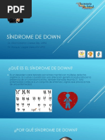 Sindrome de Down