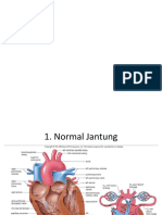 HEMOPERIKARDIUM