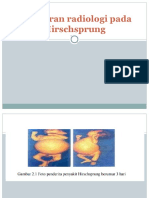 Gambaran Radiologi Pada Hisprung Dan NEC