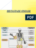 Metastaze Osoase