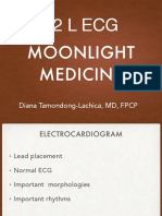 Topnotch ECG Interpretation For Moonlighters