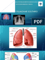 Nodulo Pulmonar Solitario