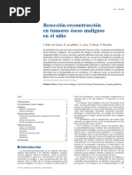 01 - Resección-Reconstrucción en Tumores Óseos Malignos en El Niño