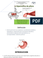 Estenosis Hipertrofica Pilorica