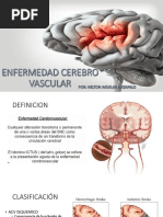 Enfermedad Cerebro Vascular