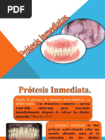 Protesis Inmediata