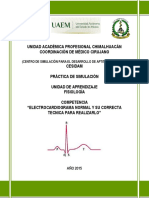 Electrocardiograma Normal y Su Correcta Tecnica para Realizarlo