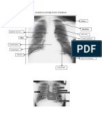 Radioanatomi Foto Thorax