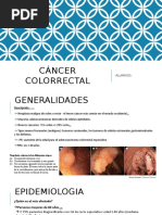 Cáncer Colorrectal