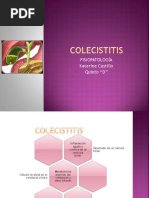 COLECISTITIS