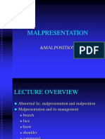 Malpresentation