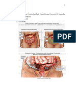 LP Peritonitis