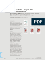 York Mason Procedure PDF