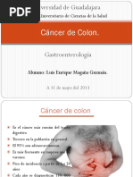 Cáncer de Colon