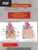 Arritmias No Letales Bradiarritmias Taquiarritmias
