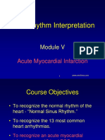 Module5 Acute Mi