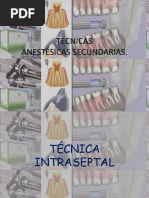 TÉCNICAS