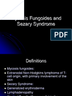 Sezary Syndrome