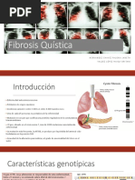 Fibrosis Quística