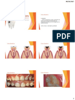 Microbiologia Da Cárie Dentária
