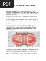 Alineacion Dentaria Interarcada