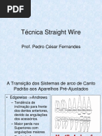 Técnica Straight Wire - Nivelamento