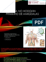 Linfoma No Hodgkin Primario de Amigdalas