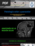 RMN - Patología Selar y Paraselar