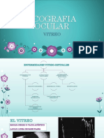 Ecografia Ocular Vitreo