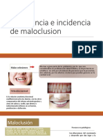 Prevalencia e Incidencia de Maloclusion