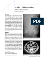 Peritonitis Plástica Miliar y Fístula Estercorácea