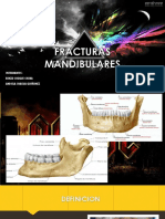 Fracturas Mandibulares