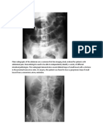 Abd X Ray