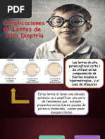 Complicaciones Altas Dioptrias