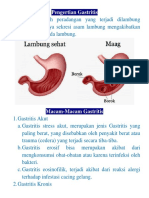 Pengertian Gastritis